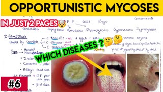 opportunistic mycoses  candidiasis aspergillosis zygomycosis in simplified way [upl. by Gaile]