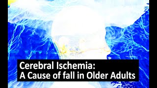 Cerebral Ischemia A Cause of fall in Older Adults [upl. by Biel]