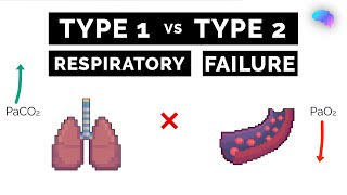 Type 1 vs Type 2 Respiratory Failure  ABG Interpretation  UKMLA  CPSA [upl. by Shayne]