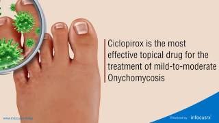 Ciclopirox is the most effective topical drug for the treatment of mildtomoderate Onychomycosis [upl. by Benjy]