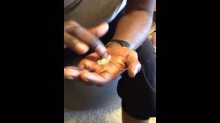 5 Minute Migraine CureVideo 1 [upl. by Currie]