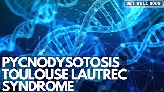 Pycnodysostosis Toulouse Lautrec Syndrome [upl. by Rebna]