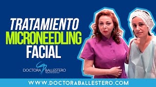 TRATAMIENTO MICRONEEDLING FACIAL [upl. by Ativla]