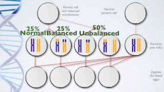 Genetics Presentation  Balance Translocation [upl. by Osanna670]