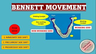 Bennett Movement and Its Classification  Bennett Angle [upl. by Eneloc]