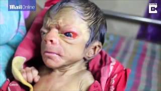 MUST WATCH A New Born Baby Looking Like An 80 Year Old Man Full Of Back Hair [upl. by Marlow]