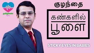 குழந்தை கண்களில் பூளை  Sticky Eyes in babies  தமிழ் [upl. by Martynne]