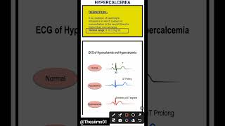 Hypercalcemia☑️hypercalcemiashortsaiimsnorcetmedicalcareerytshortsmedicalmsndisorders [upl. by Bassett]