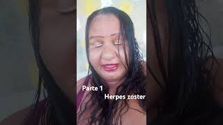 herpes zoster [upl. by Hailee826]