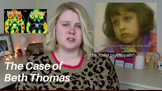 THE MIRACULOUS RECOVERY OF BETH THOMAS  THE quotCHILD PSYCHOPATHquot  CHILD OF RAGE CASE [upl. by Drusi278]