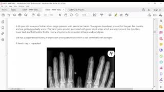 MRCP PART TWO PASSMEDICINE 2020 Endocrinology 16 [upl. by Annayat]