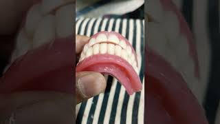 Upper Lower Complete Denture Ready completedentures dentures fulldenture [upl. by Eveleen]