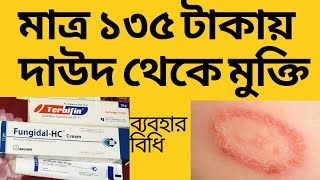 দাউদের সেরা ২ টি মলম। ব্যবহারের নিয়ম। দাম। Ringworm  Tinea treatment [upl. by Vigor728]