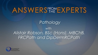 Answers from the Experts Pathology of Cutaneous Lymphoma [upl. by Nath872]