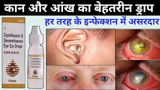 ciplox d eye ear drops  ciprofloxacin dexamethasone eye ear drops ciplox d uses in hindi [upl. by Eirrol]