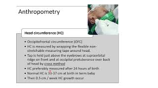 Anthropometry Measurements in Newborn  Pediatrics [upl. by Ah]