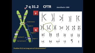 Genetic DisordersI [upl. by Messing]