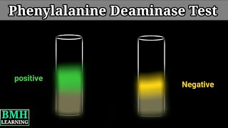 Phenylalanine Deaminase Test [upl. by Renee]