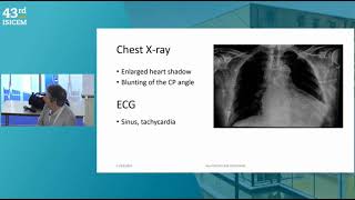 A PATIENT WITH SEVERE HYPONATREMIA ISICEM 2024 [upl. by Burrus453]