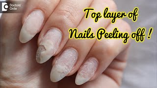 Nail flaking and peeling off Causes amp Homeopathic Treatment  Dr Sanjay Panicker Doctors Circle [upl. by Acima]