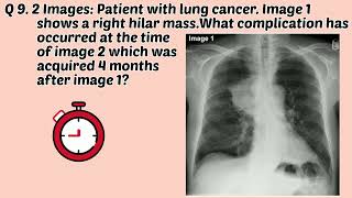 Chest X ray Image Based MCQs Part 2 radiologychannel007 [upl. by Eceirtal]