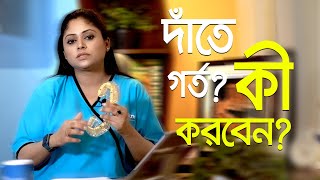 দাঁতের গর্ত কেন হয়  দাঁতের গর্ত হলে আপনাকে যা অবশ্যই করতে হবে  দাঁতের ব্যাথায় করণীয় [upl. by Asirrom]