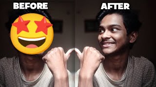 photo se emoji kaise remove kare 2024  how to remove photo emoji 🔥 [upl. by Ratna]