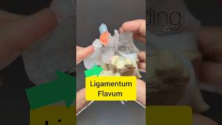 Ligamentum Flavum Modelling  Dynamic Disc Designs [upl. by Toma]