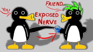 You and Your friends Exposed Nerve but its Pingu Noot Noot Animation [upl. by Maria542]