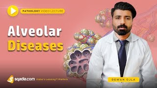 Alveolar Diseases  Basic Pathology Lectures  Medical Student  VLearning  sqadiacom [upl. by Dich]