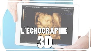 GROSSESSE Léchographie 3D  Lue Exina [upl. by Leahcim]