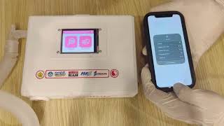 SMELTUB Smart Measurement of Early Lung Tuberculosis [upl. by Asquith922]