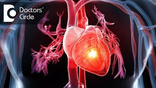 How to manage breathlessness in cardiac patients with a stent  Dr Durgaprasad Reddy B [upl. by Clio195]