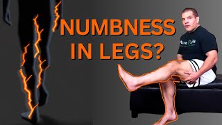 Numbness in Legs Causes and Treatment [upl. by Elia]