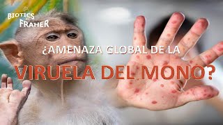 ¿AMENAZA GLOBAL DE LA VIRUELA DEL MONO [upl. by Gladine]