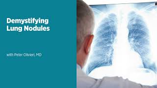 Demystifying Lung Nodules [upl. by Arvind]