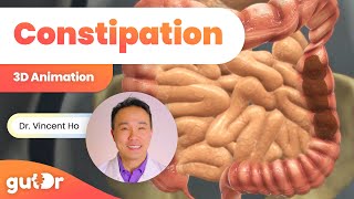 Constipation  The GutDr Explains 3D Gut Animation [upl. by Gnaht]