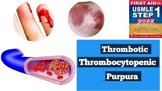 Thrombotic thrombocytopenic purpura TTPHUS Hematology lacturesDoctors goal [upl. by Anyahs]