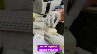 Ketone bodies are present in urine carryminati shorts [upl. by Anaihs]