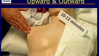 Breast Care After Radiotherapy Massage Instructions [upl. by Rosio]