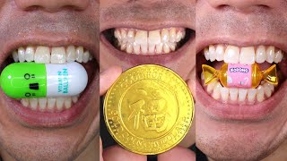 Dive into Doctor Tristan Pehs Satisfying Chewing ASMR Bliss [upl. by Ahsaek]