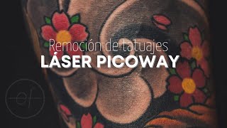 REMOCIÓN DE TATUAJES CON LÁSER PICOWAY [upl. by Shing379]