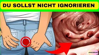 SIEBEN WARNZEICHEN FÜR DARMKREBS DIE SIE NICHT IGNORIEREN SOLLTEN [upl. by Ecinahs707]