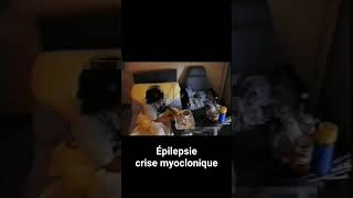 Epilepsie  crise myoclonique du réveil [upl. by Wehner543]