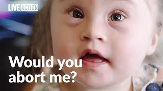 Abortion rejected by parents of child with Down syndrome [upl. by Seravat939]