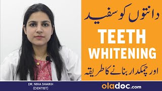 TEETH WHITENING IN URDU  Danto Ko Safaid Karne Ka Tarika  Dental Bleaching Treatment amp Procedure [upl. by Aeki166]