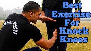 Knock Knees दूर करे With Commando  Commando Fitness Club [upl. by Nueoras]