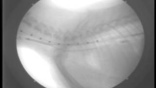 Primary Tracheal Collapse7DAY6FluoroscopyStent Placement [upl. by Geno964]