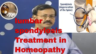 Lumbar Spondylosis  lumbar spondylosis and treatment in homeopathy Treat Back Pain spondylosis [upl. by Nnairahs]