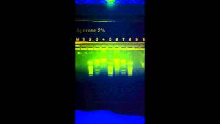 Electrophoresis Example 2 [upl. by Bainbridge]